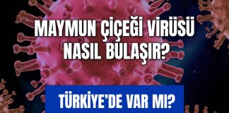 Maymun çiçeği virüsü için dünya alarmda! Türkiye’de vaka görüldü mü? Maymun Çiçeği Virüsü