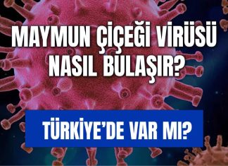 Maymun çiçeği virüsü için dünya alarmda! Türkiye’de vaka görüldü mü? Maymun Çiçeği Virüsü