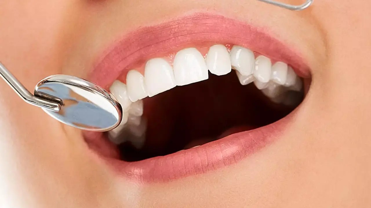 Kaybolan dişler yeniden çıkabilir
